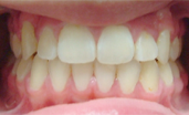 brentwood orthodontics after