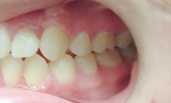 brentwood orthodontics after
