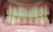 brentwood orthodontics after