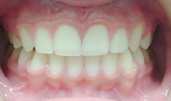 brentwood orthodontics after