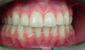 brentwood orthodontics after